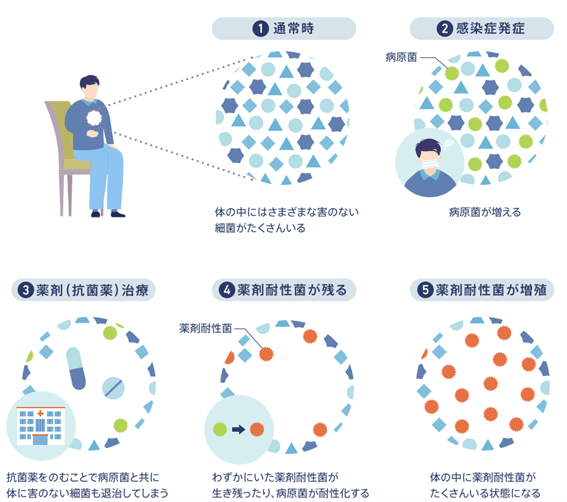 薬剤耐性菌が生まれる仕組み